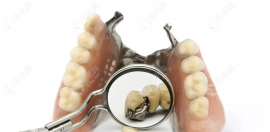 无挂钩镶牙是怎么回事?分享不带挂钩的活动假牙图片/价格等