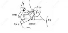 分享穿颧穿翼板种植牙技术适应症及术后有什么风险