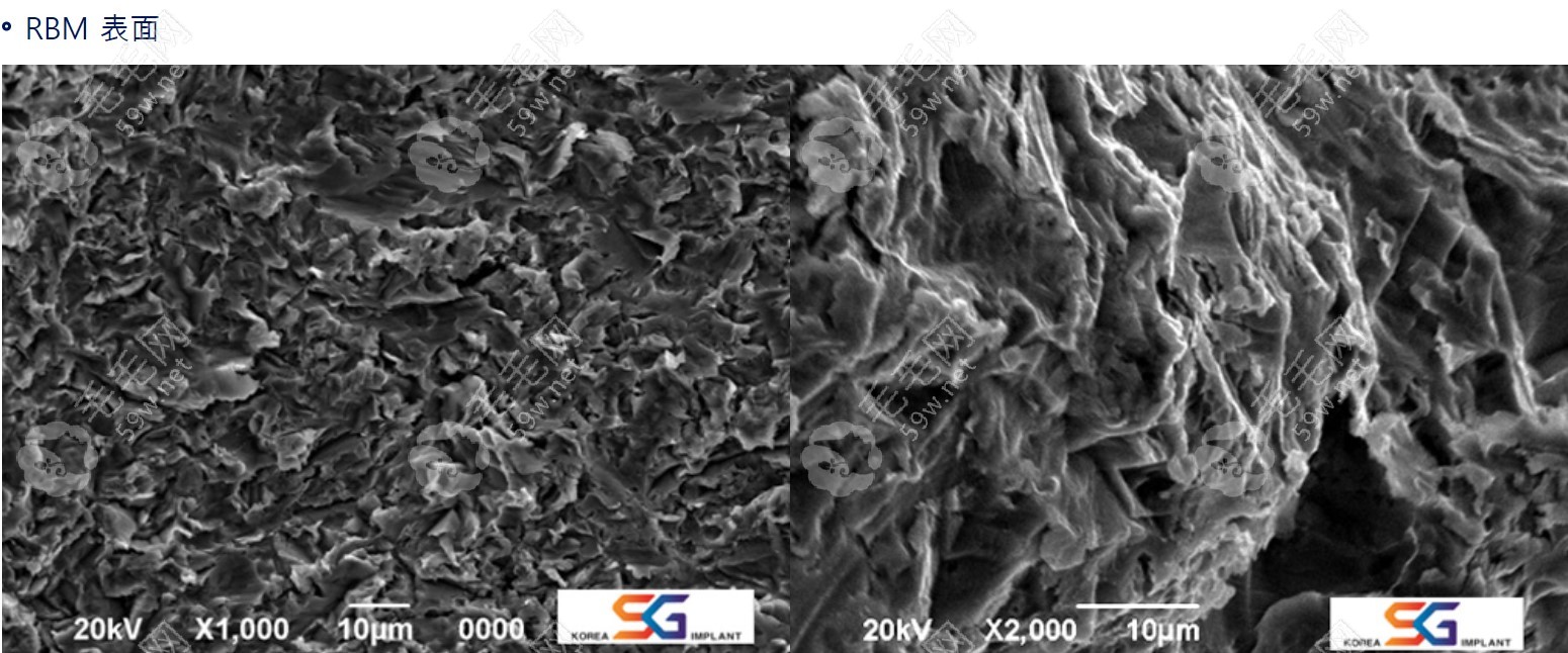 韩国sg种植体表面处理方式
