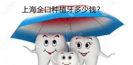 上海全口种植牙收费价目表:含即刻/微创/all-on-4全口假牙价格