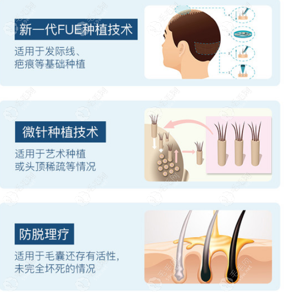 查询了成都丝恒植发价格后,知晓成都丝恒植发为什么便宜啦