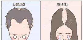 上海植发收费价格:1个毛囊单位/发际线/整个头顶植发多少钱