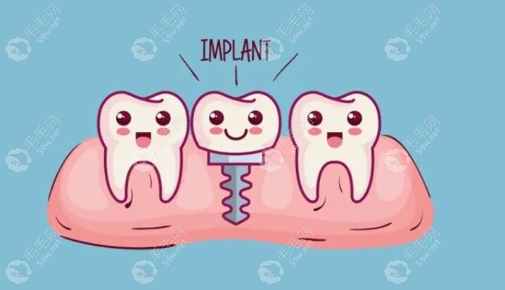 种植牙卡通图片