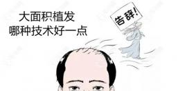 植發(fā)面積大適合哪種技術(shù)?目前常用的fue與微針植發(fā)技術(shù)不錯