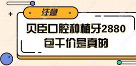 贝臣口腔种植牙2880元包干价是真的,成都/福州贝臣都适用