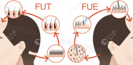 湖州植发好的医院排名前3公布:含湖州曙光/植发价格表