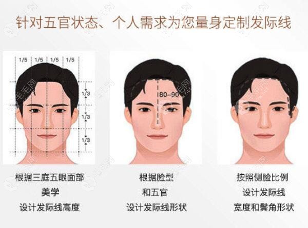 苏州百年植发优惠政策多少钱