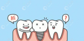 韩国种植牙和国产种植牙哪个好,种植牙集采后价格相差不大