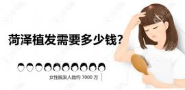 菏澤植發(fā)需要多少錢(qián)?從發(fā)際線高到正規(guī)植發(fā)醫(yī)院價(jià)格詳悉