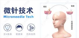 北京做微針植發(fā)比較好的醫(yī)院排名及價格曝光,植發(fā)朋友必看