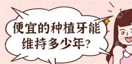 便宜的种植牙能维持多少年?5年/10年/20年还是终身呢