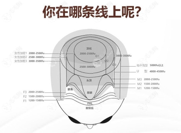 毛囊數(shù)量參考圖