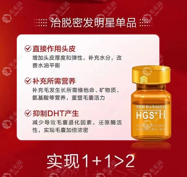 深圳鹏程治脱发明星单品是skm丝科慕,另有pst微针植发技术