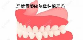 我带了10年的活动假牙,现在牙槽骨萎缩假牙挂不住能种牙吗?