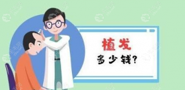 内蒙古呼和浩特植发多少钱,呼市植发医院植发价格表有说
