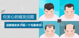 成都植发多少钱一个毛囊单位?大麦/首瑞/植发价格10元起