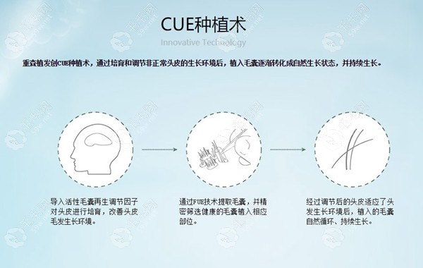 重森植发技术m.59w.net