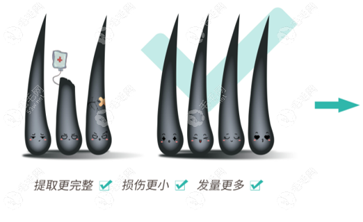 新生3d植发技术介绍