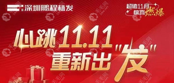 深圳鹏程植发优惠活动:M字额/头顶稀疏脱发植发300单位11元起