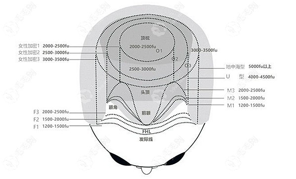 鹰潭正规植发医院排名榜,look鹰潭毛发移植机构有哪些哪家好