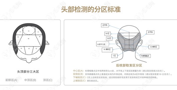 公布植发价格,专科机构养护头发和植发收费都不贵