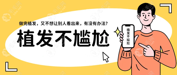 昆明不剃发植发的医院有哪些?不剃发植发机构推荐名单在此