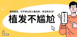 昆明不剃发植发的医院有哪些?不剃发植发机构推荐名单在此