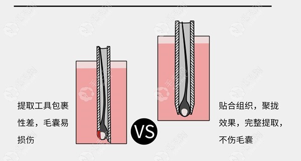 南阳市植发科怎么样?公办机构可信赖/植发价格合理