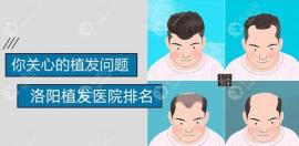 洛陽植發(fā)醫(yī)院排名出爐,其中不乏有未毛這樣的毛發(fā)?？茩C(jī)構(gòu)