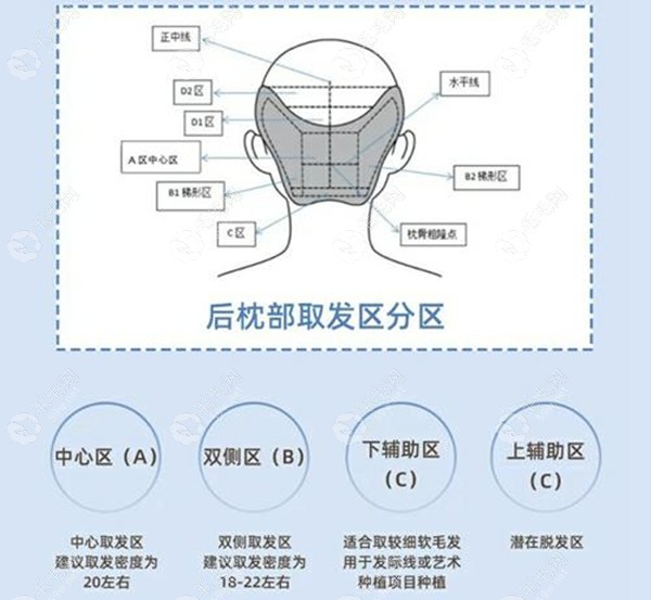 揭贵阳技术比较好植发医院名单,碧莲盛/丽都等正规机构胜出