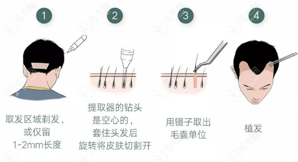 宜春名星植发医生甘柳明