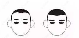 額頭窄脫發(fā)際線一般需要多少錢(qián)?3-4k去美容院還是醫(yī)院都能弄