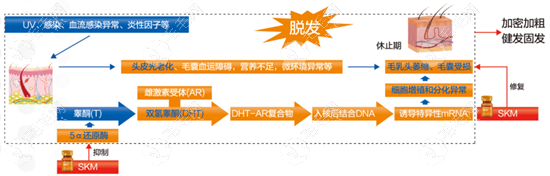 丝科慕SKM能治脂溢性脱发原理