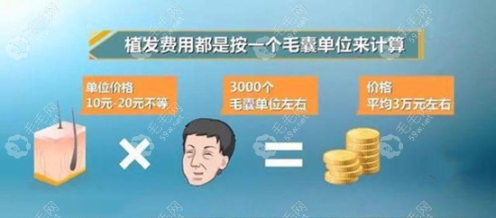 500个毛囊单位植发多少钱！