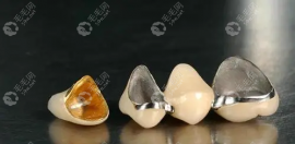 烤瓷牙能用一辈子吗?话说烤瓷牙的寿命是几年