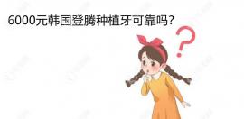 6000元韩国登腾种植牙靠谱吗?靠谱,现在登腾平均价格3000左右