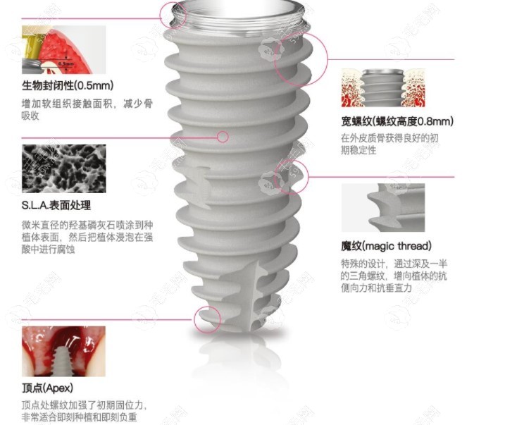 纽百特种植体介绍