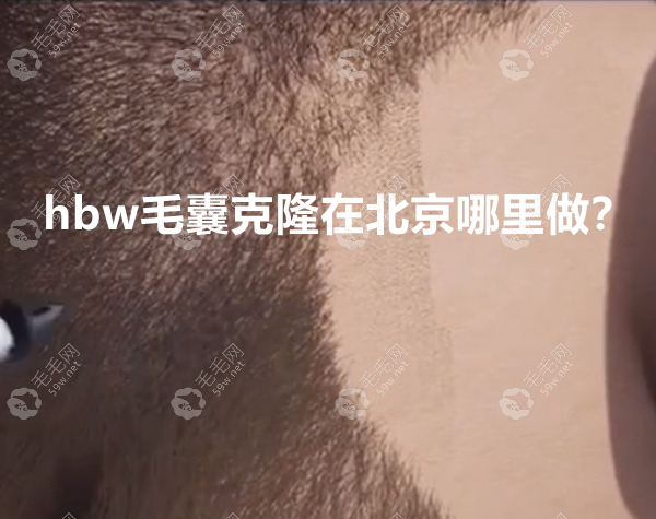 hbw毛囊克隆在北京哪里能做?北京hbw毛囊克隆医院技术新动态