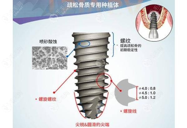 奥齿泰种植系统59w.net