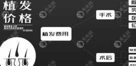 福州重森植發(fā)價(jià)格多少錢,查詢到2025種發(fā)際線等費(fèi)用表供參考