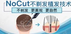 鄭州不剃發(fā)植發(fā)醫(yī)院哪個好?碧蓮盛/大麥/芳藝不剃發(fā)技術(shù)高