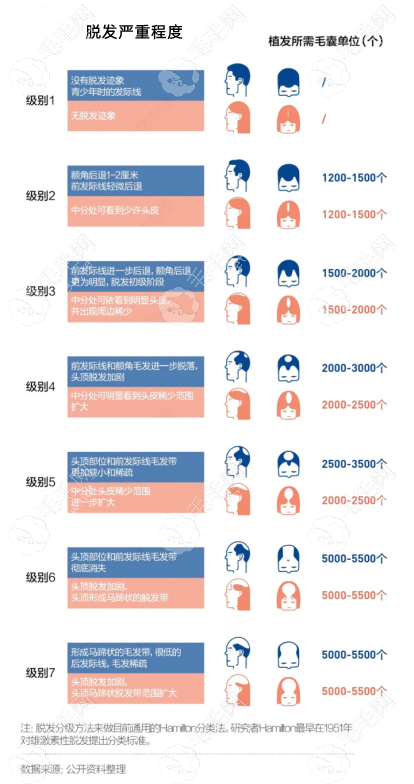 植发数量计算图