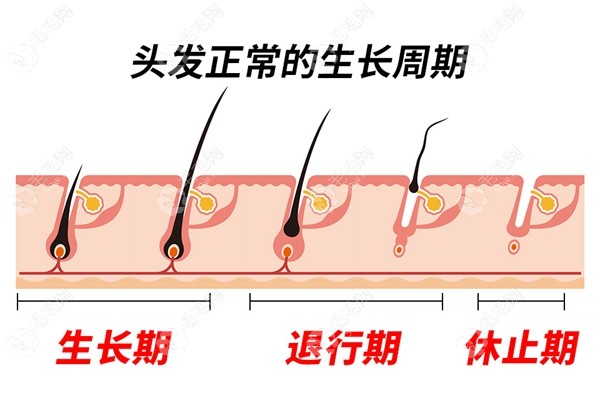 植发后多久进入头发生长稳定期和生长期