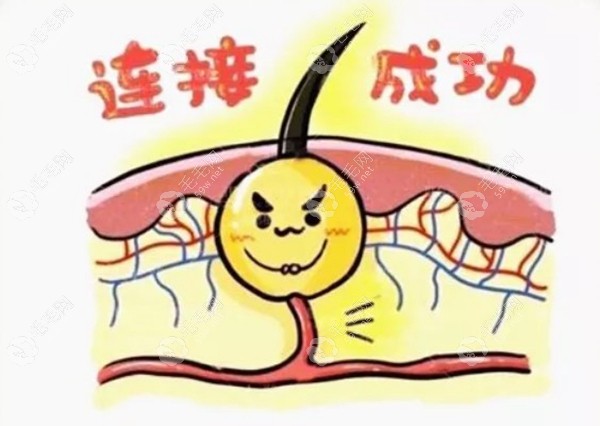 毛囊稳固状态