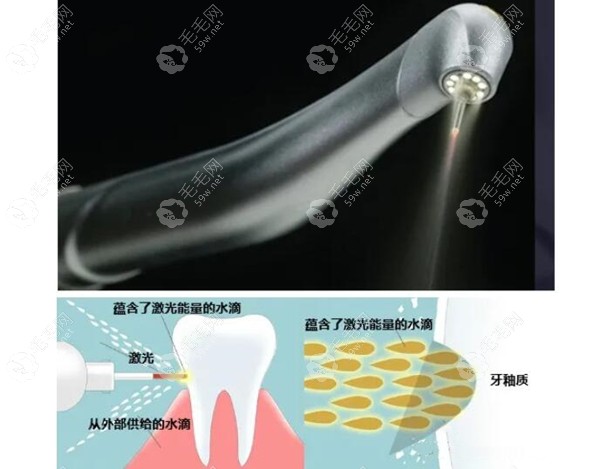 水激光设备的原理图