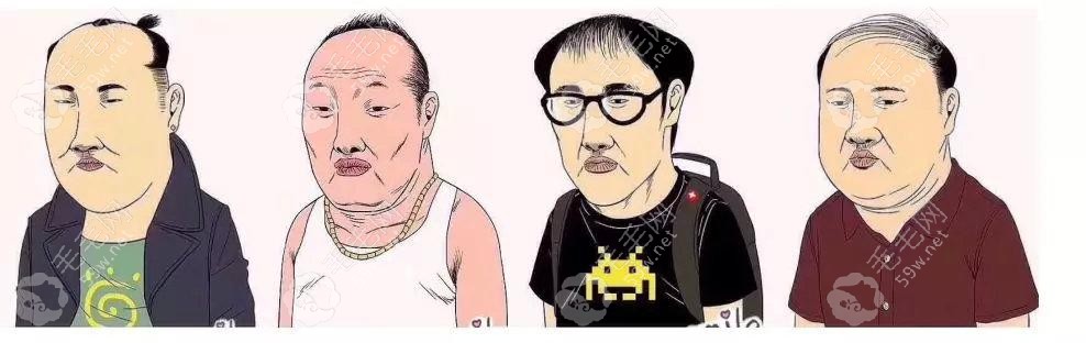 青岛碧莲盛植发医生罗继森考虑