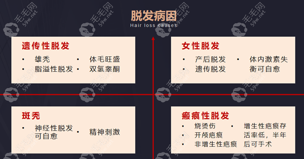 毳生毛发移植擅长项目/技术