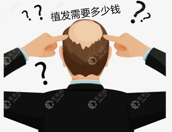 国内正规植发医院做植发手术收费