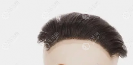 再生发际线真的可以再生毛囊么?用它生发和植发的区别是啥?