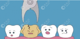拔牙多少钱一颗2023价格表,美奥/牙博士/维乐口腔拔智齿价格